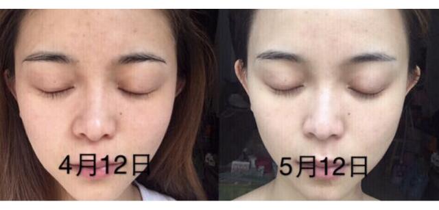 美容仪到底管用吗（揭秘美容仪黑幕）(25)