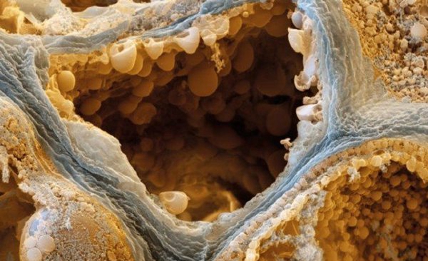 是什么缘故牺牲人最多?人类牺牲缘故排名前10