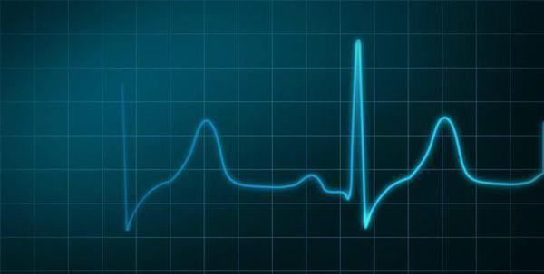 静息心指数是指,心指数等于图4