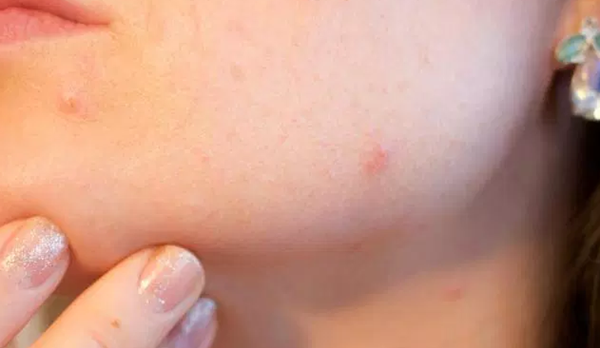 芦荟有什么妙用?芦荟的十大功能与效率