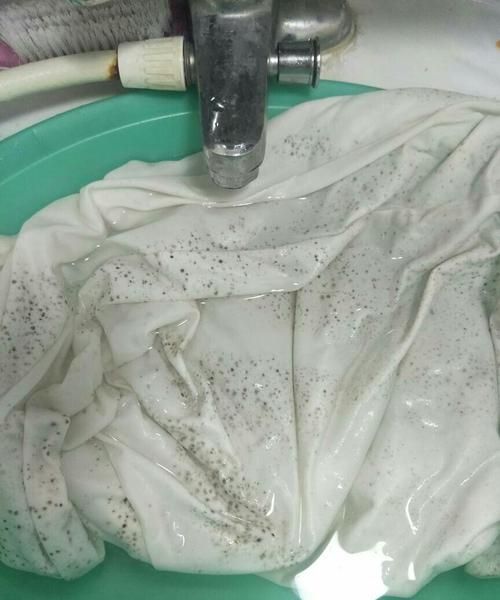 衣服后背发霉的衣服用什么洗能洗掉