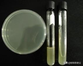 条件培养基的制备_微生物培养基的制备-第1张图片-