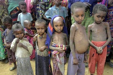 非洲饥荒罕见照,大人小孩都瘦得吓人,日常吃黄泥饼、牛粪充饥