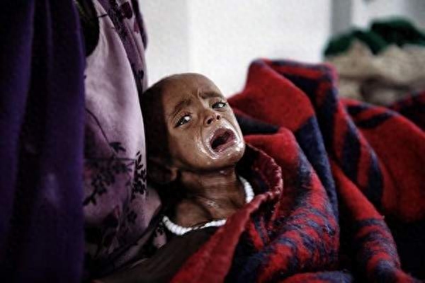 非洲饥荒罕见照,大人小孩都瘦得吓人,日常吃黄泥饼、牛粪充饥