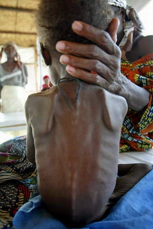 非洲饥荒罕见照,大人小孩都瘦得吓人,日常吃黄泥饼、牛粪充饥