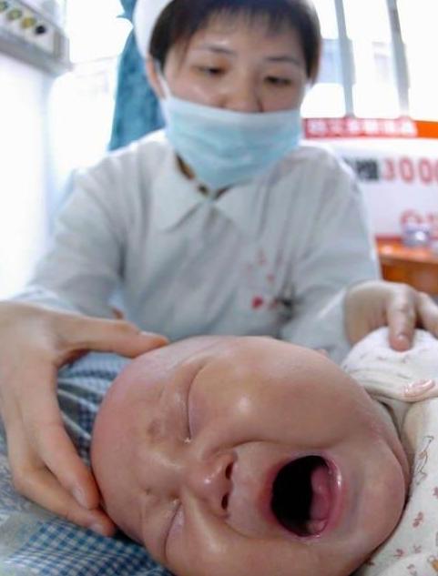 11年前因喝三鹿奶粉,变成的“大头娃娃”,如今他们都被毁了!