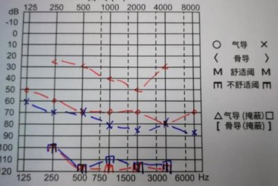 ​教您一分钟看懂听力图