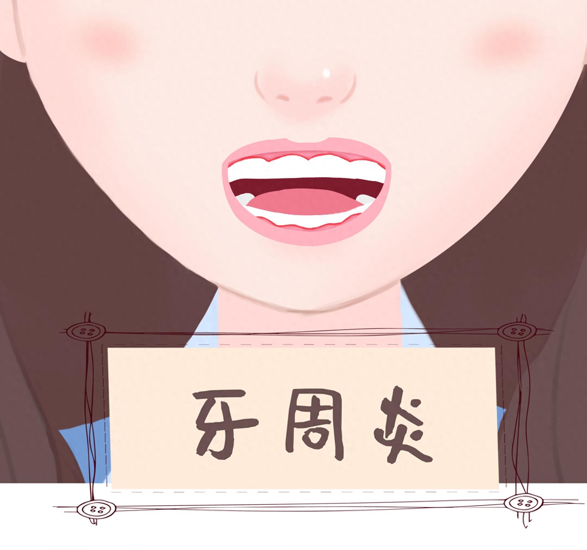牙齿各种病变图解，你中招了吗？