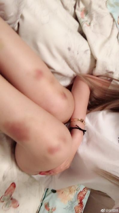 斗鱼主播琪格(主播张琪格为嘉年华秒杀一众女主播)(2)