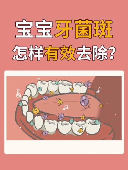 怎么去除牙垢（可以用这三个方法）